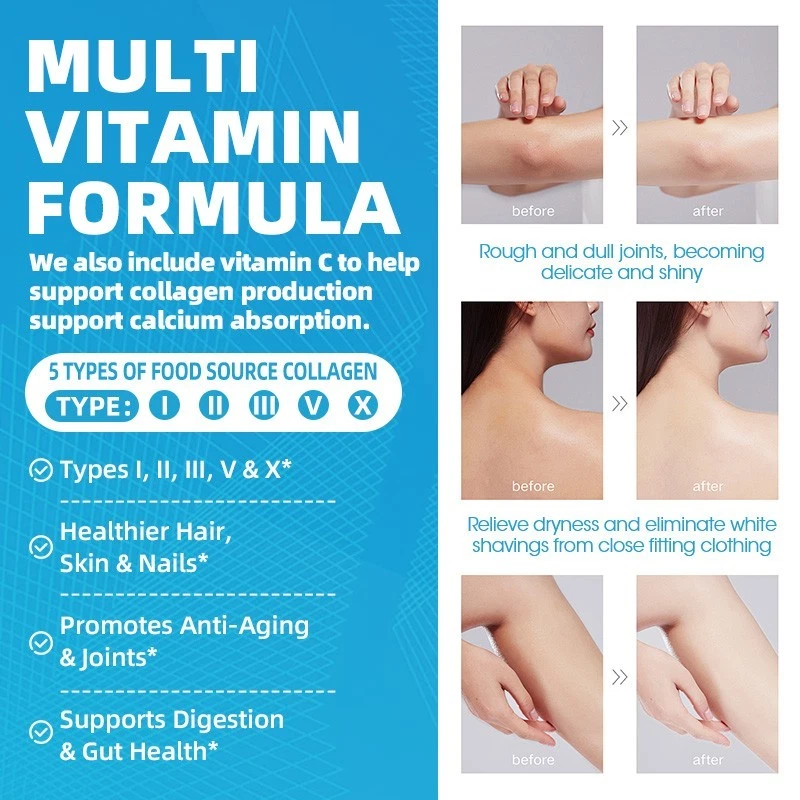 Collagen Peptides Types I, II, III, V, X Anti-Aging Skin Support 120 Softgels-GPGP — image 4